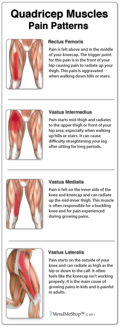 Quadriceps Muscle Strain